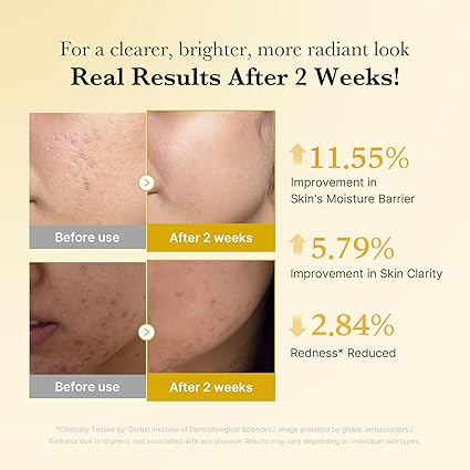 Medicube Clarifying Serum – Kojic Acid, Turmeric & Niacinamide Capsules