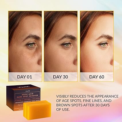 VALITIC Kojic Acid Soap – Brightening & Anti-Aging, 2 Pack