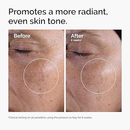 The Ordinary Glycolic Acid 7% Exfoliating Toner – Brightening & Smoothing
